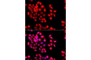 Immunofluorescence analysis of A549 cells using STXBP2 antibody. (STXBP2 anticorps)