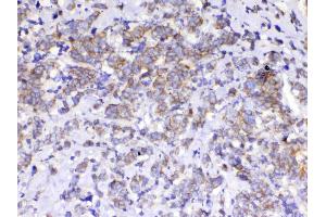 IHC analysis of beta Catenin using anti-beta Catenin antibody .