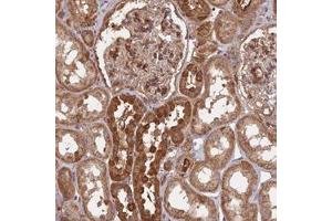 Immunohistochemical staining of human kidney with SAC3D1 polyclonal antibody  shows strong cytoplasmic positivity in cells in tubules at 1:200-1:500 dilution. (SAC3D1 anticorps)