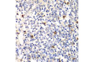 Immunohistochemistry of paraffin-embedded mouse spleen using PSMD7 antibody (ABIN5973092) at dilution of 1/100 (40x lens). (PSMD7 anticorps)