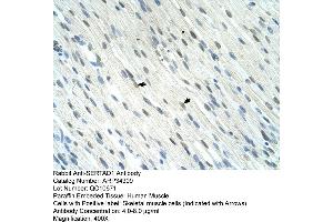 anti-SERTA Domain Containing 1 (SERTAD1) (N-Term) antibody