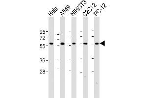 All lanes : Anti-hPKM2- at 1:2000 dilution Lane 1: Hela whole cell lysate Lane 2: A549 whole cell lysate Lane 3: NIH/3T3 whole cell lysate Lane 4: C2C12 whole cell lysate Lane 5: PC-12 whole cell lysate Lysates/proteins at 20 μg per lane.