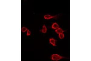 ABIN6266530 staining Hela by IF/ICC. (Dysferlin anticorps  (C-Term))