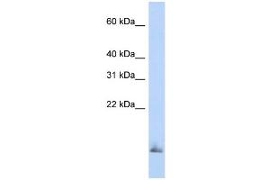 WB Suggested Anti-SCGB1A1 Antibody Titration:  0. (SCGB1A1 anticorps  (Middle Region))