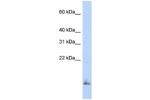 WB Suggested Anti-SCGB1A1 Antibody Titration:  0.