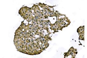 IHC analysis of TCEB2/Elongin-B/ELOB using anti-TCEB2/Elongin-B/ELOB antibody (ABIN7598964).