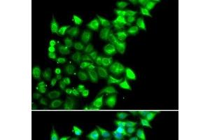 Immunofluorescence analysis of U2OS cells using MEST Polyclonal Antibody (MEST anticorps)