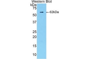 Western blot analysis of the recombinant protein. (Complement Factor B anticorps  (AA 34-159))