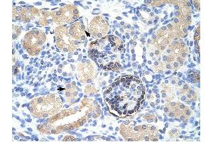 CLIC5 antibody was used for immunohistochemistry at a concentration of 4-8 ug/ml to stain Epithelial cells of renal tubule (arrows) in Human Kidney. (CLIC5 anticorps  (C-Term))