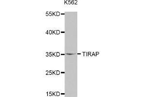 Western Blotting (WB) image for anti-Toll-Interleukin 1 Receptor (TIR) Domain Containing Adaptor Protein (TIRAP) antibody (ABIN1875100) (TIRAP anticorps)
