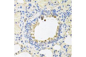 Immunohistochemistry of paraffin-embedded rat lung using SKAP2 antibody at dilution of 1:100 (x40 lens).