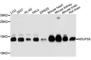 Western blot analysis of extracts of mouse liver tissue lines, using NDUFS5 antibody. (NDUFS5 anticorps)