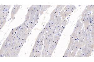 Detection of SEMA3A in Human Heart Tissue using Monoclonal Antibody to Semaphorin 3A (SEMA3A) (SEMA3A anticorps  (AA 580-664))