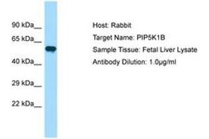 Image no. 1 for anti-Phosphatidylinositol-4-Phosphate 5-Kinase, Type I, beta (PIP5K1B) (AA 395-444) antibody (ABIN6750033) (PIP5K1B anticorps  (AA 395-444))
