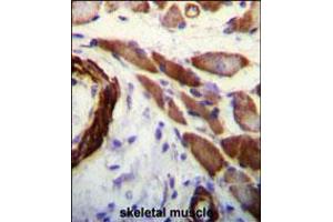 FLNA Antibody (Y1046) immunohistochemistry analysis in formalin fixed and paraffin embedded human skeletal muscle followed by peroxidase conjugation of the secondary antibody and DAB staining.