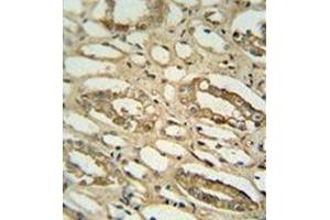 Immunohistochemistry analysis in formalin fixed and paraffin embedded human lung tissue reacted with GGTLC2 Antibody (Center) followed peroxidase conjugated to the secondary antibody and followed by DAB staining. (GGTLC2 anticorps  (Middle Region))