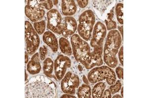 Immunohistochemical staining of human kidney with CPSF3L polyclonal antibody  shows strong cytoplasmic positivity in cells in tubules.