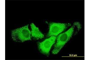 Immunofluorescence of monoclonal antibody to SCYE1 on HeLa cell. (AIMP1 anticorps  (AA 1-312))