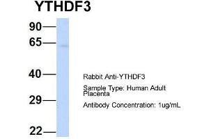 Host: Rabbit  Target Name: YTHDF3  Sample Tissue: Human Adult Placenta  Antibody Dilution: 1.