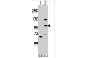 Western blot analysis of MLK4 (arrow) using rabbit MLK4 polyclonal antibody . (MLK4 anticorps  (N-Term))
