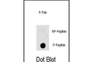 Dot blot analysis of anti-K1-p Phospho-specific b (ABIN389799 and ABIN2839695) on nitrocellulose membrane. (MAP3K8 anticorps  (pThr290))