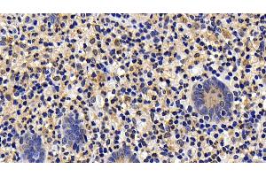 Detection of Bid in Human Appendix Tissue using Polyclonal Antibody to BH3 Interacting Domain Death Agonist (Bid) (BID anticorps  (AA 1-195))