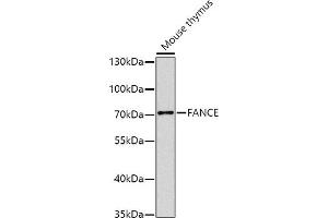 Western blot analysis of extracts of mouse thymus, using FANCE antibody (ABIN6129378, ABIN6140472, ABIN6140473 and ABIN6224472) at 1:1000 dilution. (FANCE anticorps  (AA 1-255))