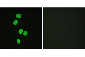 Immunofluorescence analysis of HeLa cells, using AS160 (Ab-642) Antibody. (TBC1D4 anticorps  (AA 611-660))