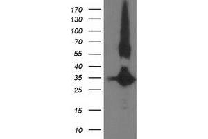 Western Blotting (WB) image for anti-Monoglyceride Lipase (MGLL) antibody (ABIN1499437) (MGLL anticorps)