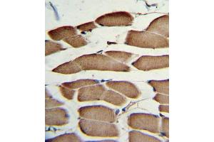 Immunohistochemistry (IHC) image for anti-Wingless-Type MMTV Integration Site Family, Member 5B (WNT5B) antibody (ABIN3003826)
