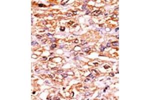 Image no. 1 for anti-Cyclin-Dependent Kinase Inhibitor 1B (p27, Kip1) (CDKN1B) (pSer178) antibody (ABIN358184)