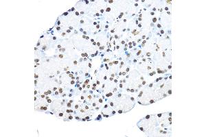 Immunohistochemistry of paraffin-embedded rat pancreas using NR5 Rabbit pAb (ABIN6133574, ABIN6144832, ABIN6144834 and ABIN6217774) at dilution of 1:100 (40x lens). (NR5A2 + LRH1 anticorps  (AA 1-140))
