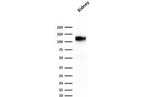 Western Blot Analysis of human kidney tissue lysate using KSP-Cadherin Recombinant Mouse Monoclonal Antibody (rCDH16/1071).