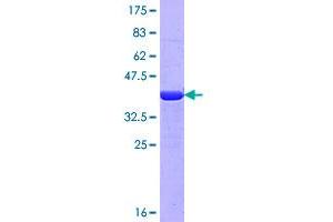 Image no. 1 for Myosin 9 (MYH9) (AA 1747-1852) protein (GST tag) (ABIN1311753)