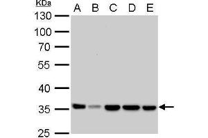 WB Image LDHA antibody detects LDHA protein by Western blot analysis. (Lactate Dehydrogenase A anticorps)