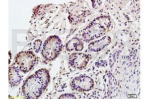 Formalin-fixed and paraffin embedded rat colitis tissue labeled with Anti CD98 Polyclonal Antibody, Unconjugated (ABIN719546) at 1:200 followed by conjugation to the secondary antibody and DAB staining