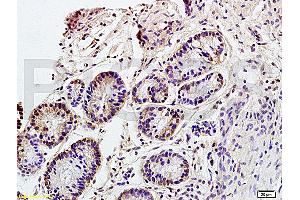 Formalin-fixed and paraffin embedded rat colitis tissue labeled with Anti CD98 Polyclonal Antibody, Unconjugated (ABIN719546) at 1:200 followed by conjugation to the secondary antibody and DAB staining (SLC3A2 anticorps  (AA 231-280))