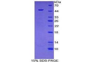 SDS-PAGE analysis of Mouse HYAL1 Protein. (HYAL1 Protéine)