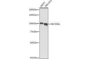 Western blot analysis of extracts of various cell lines, using HSP90B1 antibody (ABIN6130434, ABIN6142031, ABIN6142033 and ABIN7101795) at 1:1000 dilution.