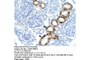 Human kidney (EIF2AK2 anticorps  (C-Term))