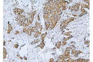 IHC analysis of Filamin B/FLNB using anti-Filamin B/FLNB antibody (ABIN7601607).