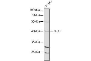 Western blot analysis of extracts of K-562 cells, using BGAT antibody (ABIN3022190, ABIN3022191, ABIN3022192 and ABIN6218658) at 1:1000 dilution. (ABO anticorps  (AA 54-354))