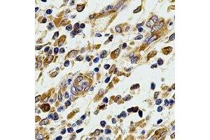 Immunohistochemical analysis of COX2 staining in human stomach formalin fixed paraffin embedded tissue section. (COX2 anticorps)