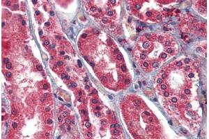 Human Kidney: Formalin-Fixed, Paraffin-Embedded (FFPE)