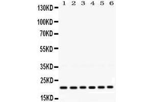 Western Blotting (WB) image for anti-RAB10, Member RAS Oncogene Family (RAB10) (AA 153-185), (C-Term) antibody (ABIN3043448)