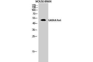 Western Blotting (WB) image for anti-gamma-aminobutyric Acid (GABA) A Receptor, alpha 6 (GABRA6) (Internal Region) antibody (ABIN3175195) (GABRA6 anticorps  (Internal Region))