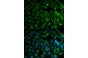Immunofluorescence analysis of U2OS cells using HPD antibody. (HPD anticorps  (AA 1-393))
