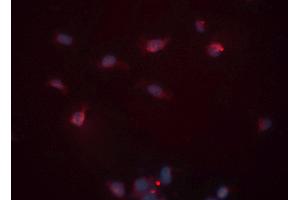 ABIN6276530 staining HeLa cells by ICC/IF.