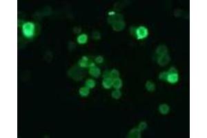 Immunofluorescence (IF) image for anti-Cyclin-Dependent Kinase Inhibitor 2B (p15, Inhibits CDK4) (CDKN2B) antibody (ABIN1449282)
