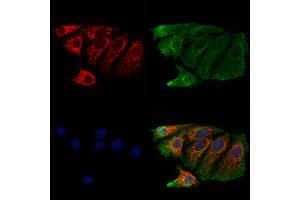 ABIN6261004 and ABIN6273214 staining Hela cells by IF/ICC.